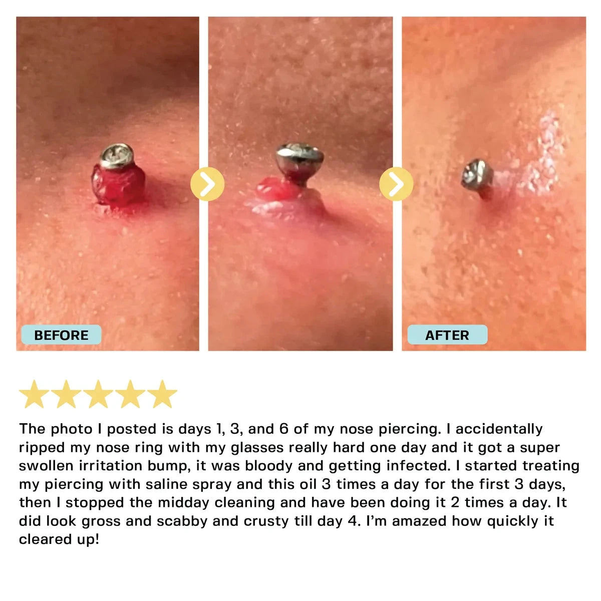 Piercing Bump Oil Topical Base Laboratories 