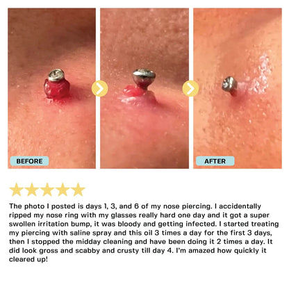 Piercing Bump Oil Topical Base Laboratories 