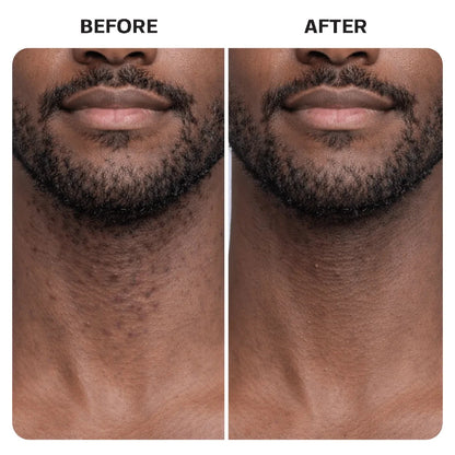 Razor Bump Rescue Duo Base Laboratories 