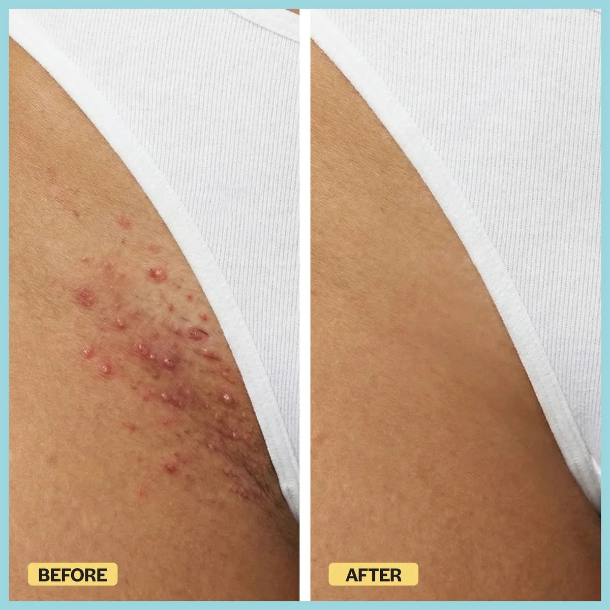 Razor Bump Rescue Duo Base Laboratories 
