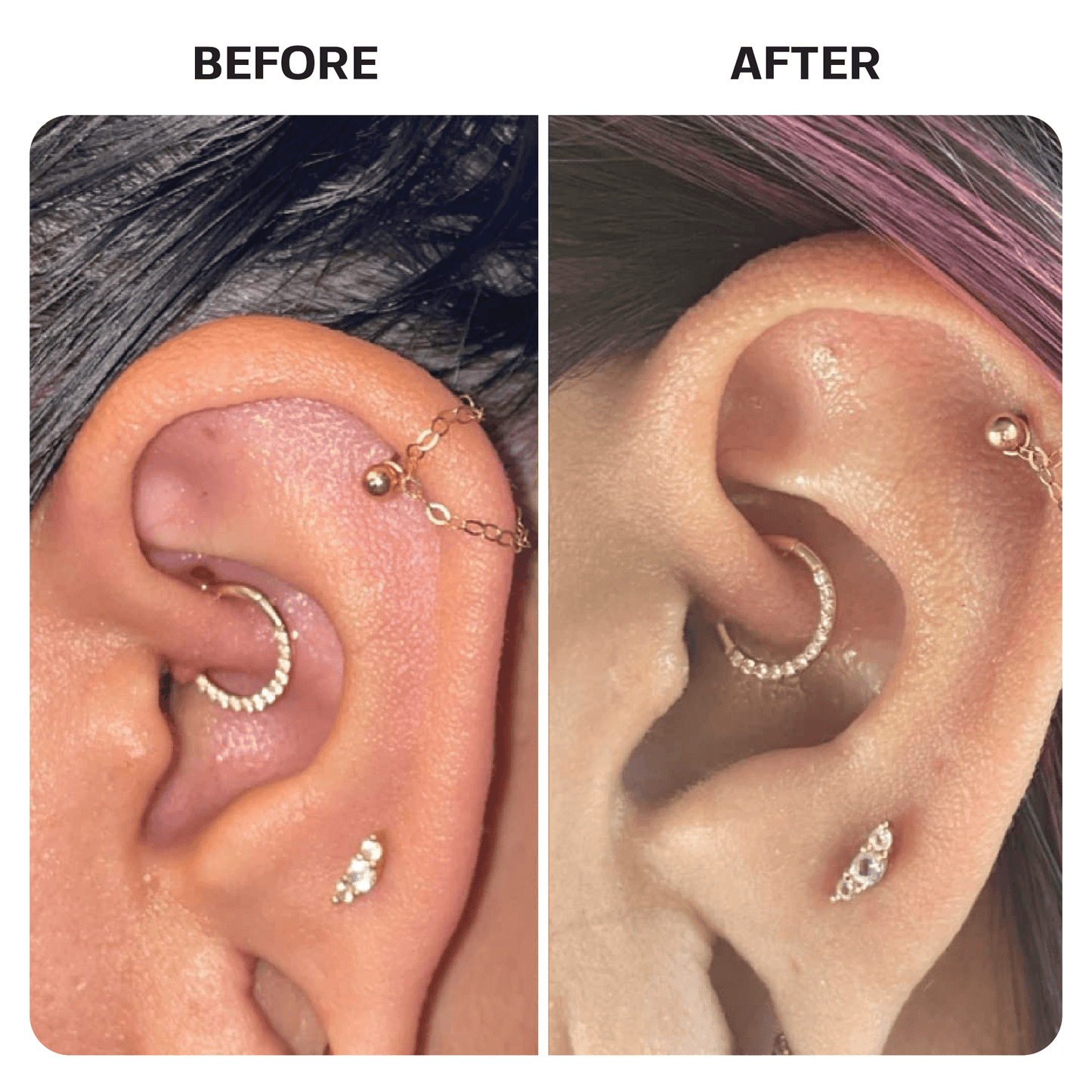 Saline Gel Piercing Base Laboratories 