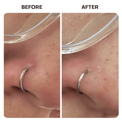 Saline Gel Piercing Base Laboratories 