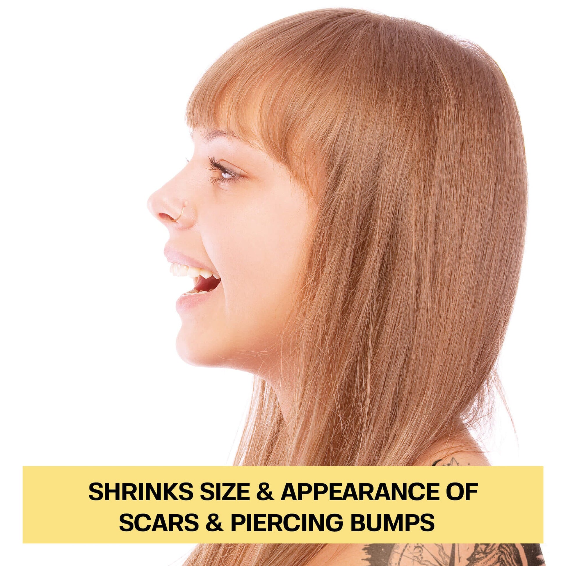 Ultimate Keloid Scar Trio Bundle Base Laboratories 