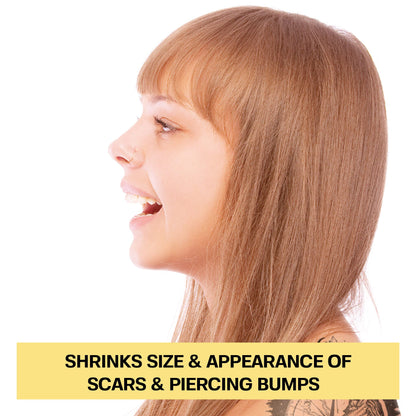 Ultimate Keloid Scar Trio Bundle Base Laboratories 